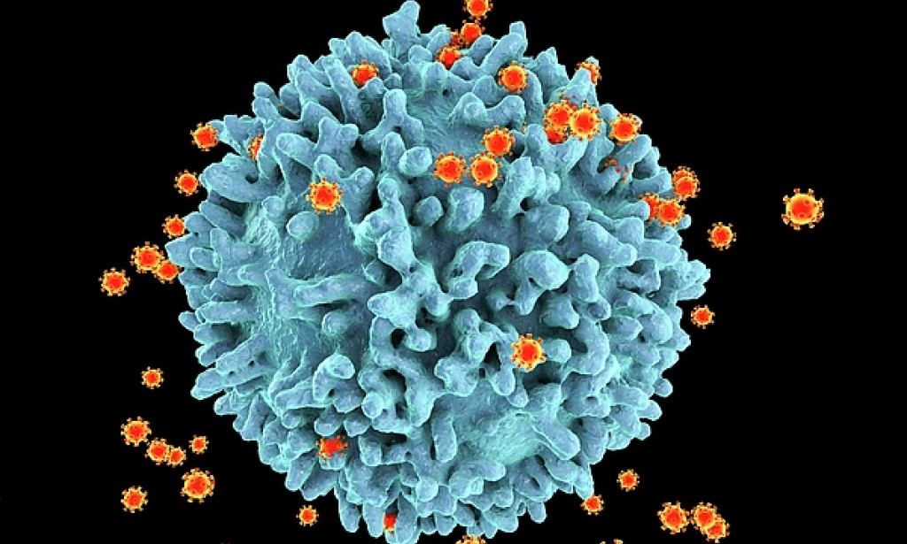 Understanding the AIDS Virus: Origins, Impact, and Advances in Treatment